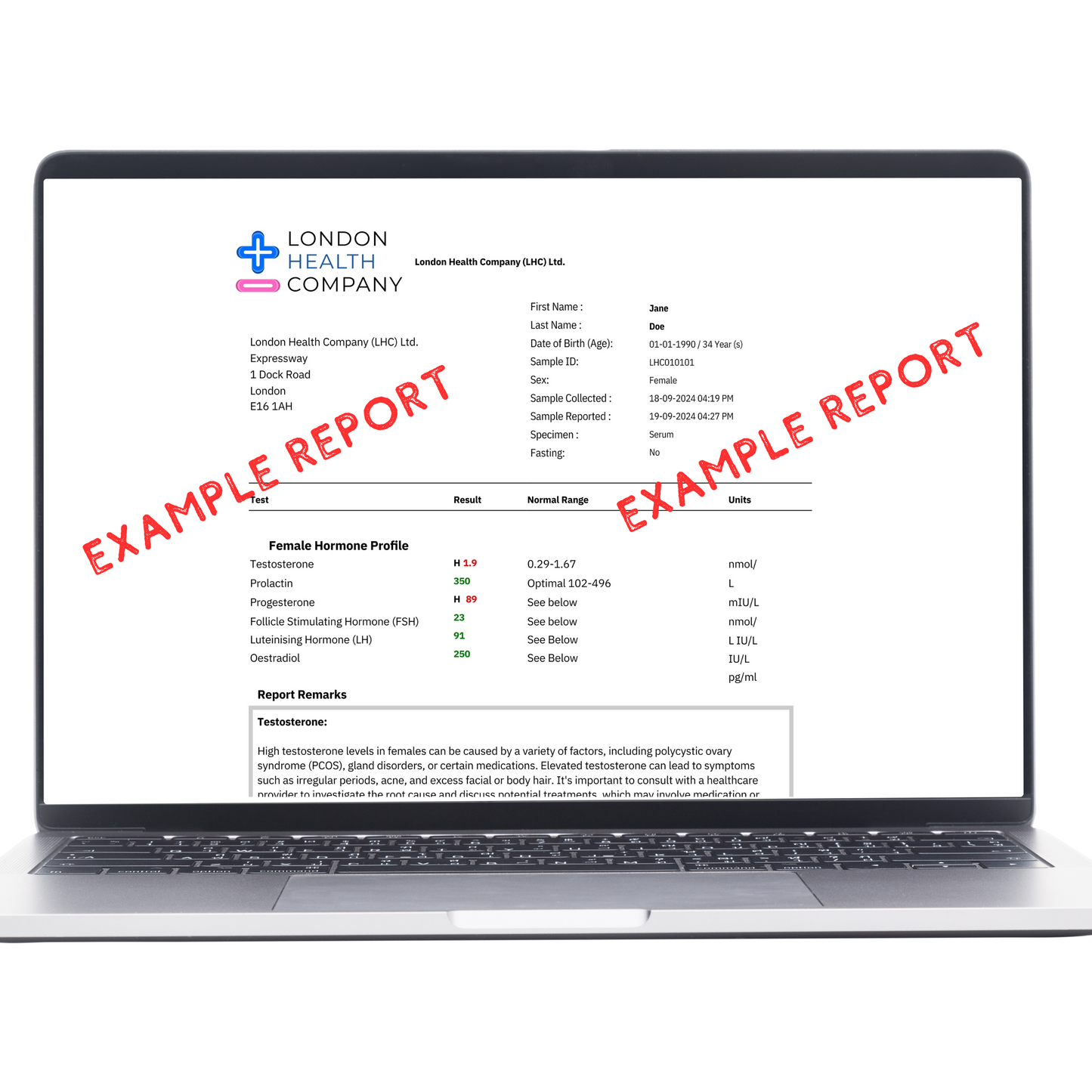 Liver function home test kit quantitative result report