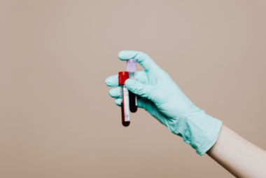 Hand wearing a green glove holding a blood sample tube against a beige background